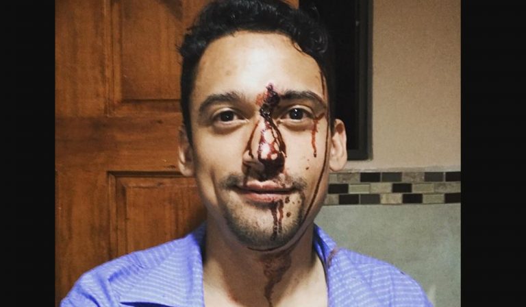 Ministro ordena investigar supuesta inacción de Fuerza Pública ante agresión homofóbica en San Pedro