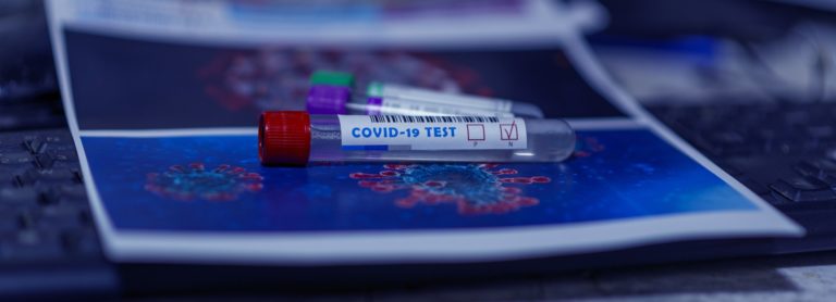 Hipótesis sobre origen del COVID-19 se disparan tras un nuevo reporte del FBI