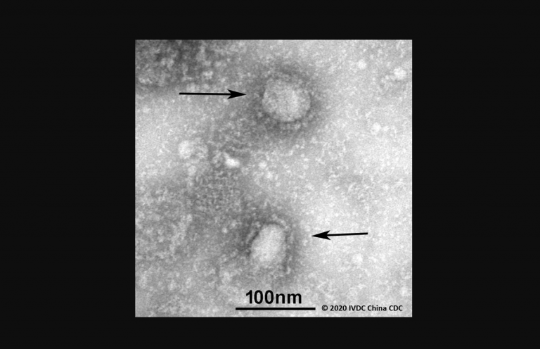 Muere segunda persona infectada con extraña neumonía parecida al SARS
