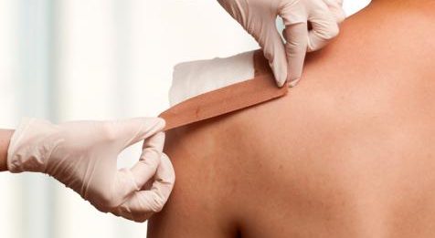 Imagen principal del artículo: Leukoplast donó 8.000 apósitos para pacientes y personal médico de la CCSS