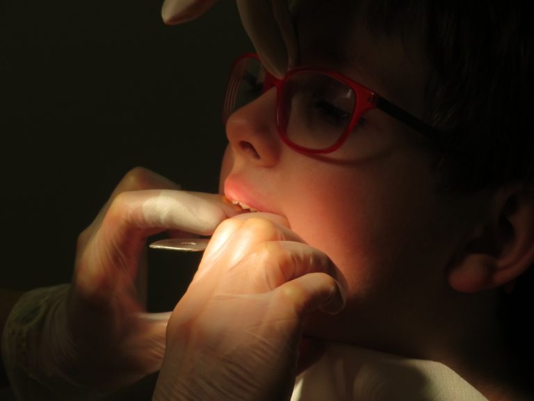 Los beneficios de la atención temprana en casos del apiñamiento dental