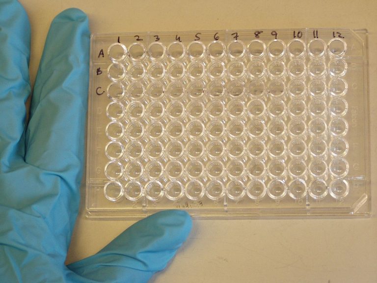 Ministerio de Salud avala uso de pruebas de anticuerpos de SARS-CoV-2