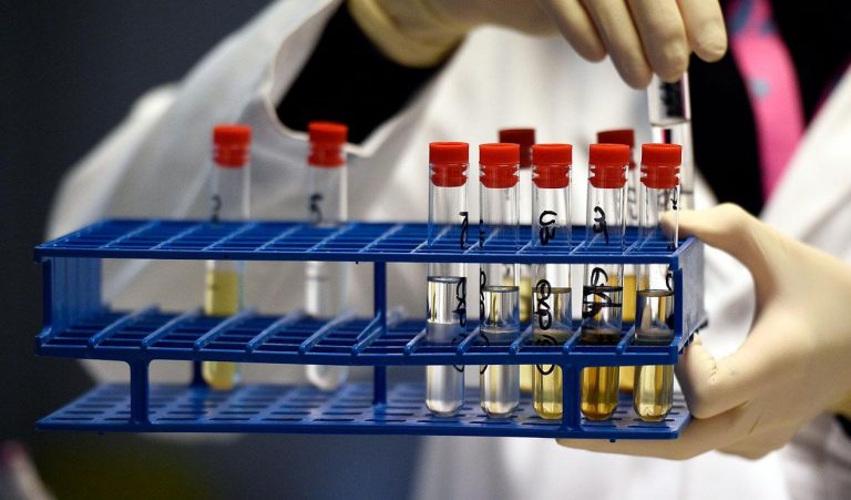 CONAD-CR advierte que tratamiento contra COVID-19 podría generar positivos en pruebas doping