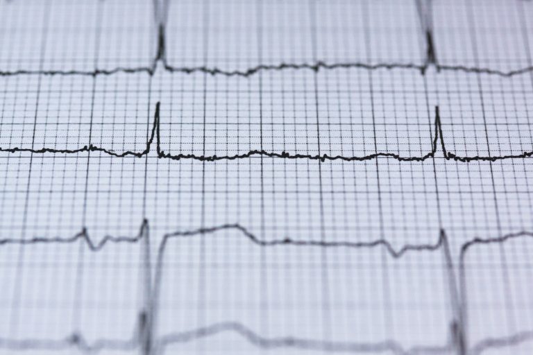 Los mitos de las enfermedades bucales relacionados con el nivel cardiovascular