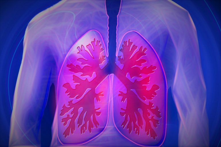 ¡Acabemos con la Tuberculosis!