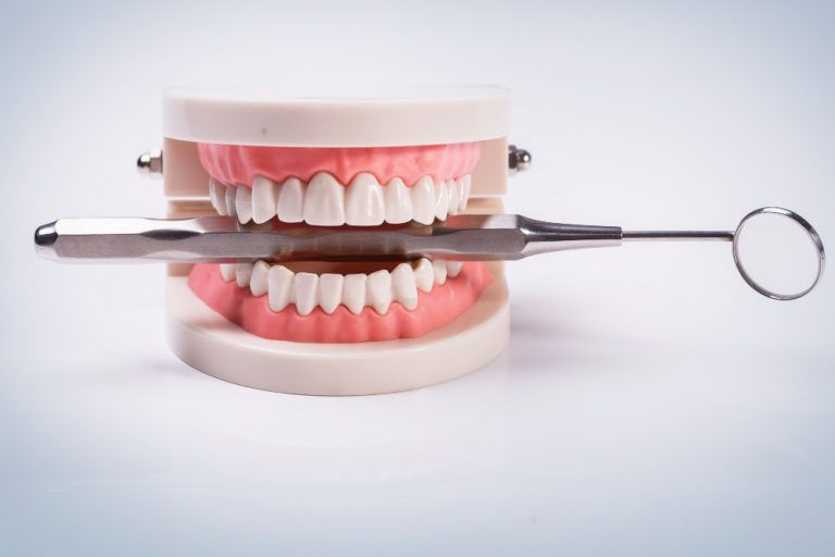 Hiperplasia gingival, conozca lo qué es y sus causas más comunes