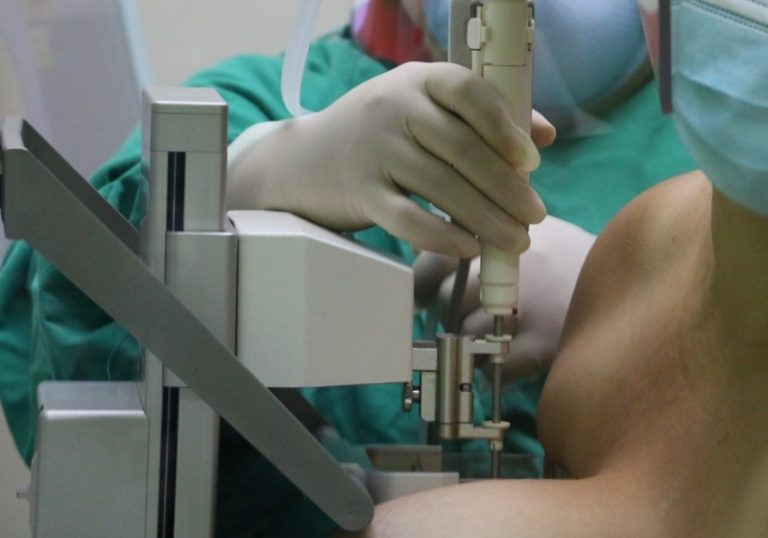 COOPESANA R.L ofrecerá 800 mamografías gratuitas para mujeres mayores de 40 años
