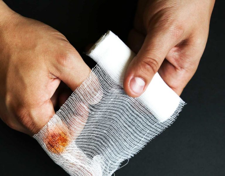 Pacientes con hemofilia piden a la Caja que amplíe la gama de sus medicamentos disponibles