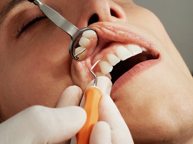 Analicemos si los problemas dentales o de encías nos hace más vulnerables a trastornos serios de salud si contraemos coronavirus