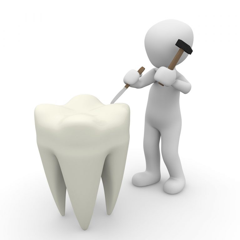 Tratamientos dentales baratos: ¿competencia desleal o materiales de mala calidad?
