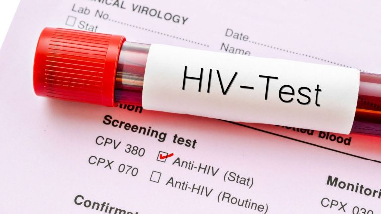 Zimbabue deroga ley que penalizaba con cárcel la transmisión del VIH