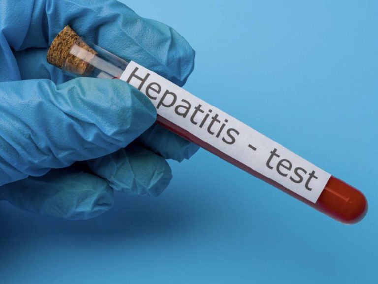 Salud reporta 14 casos de hepatitis A en lo que llevamos del 2023
