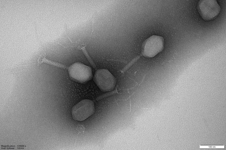 ¿Qué es la fagoterapia?