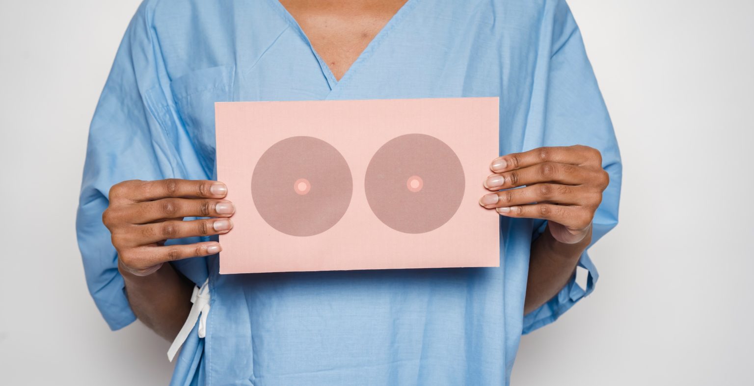 Imagen principal del artículo: El 90% de las mujeres con cáncer de mama sobreviven si son diagnosticadas a tiempo, según Roche y el NCI