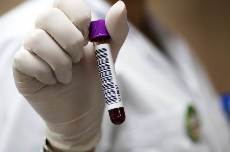 Avance en oncología: La UCR introduce biopsia líquida accesible para pacientes