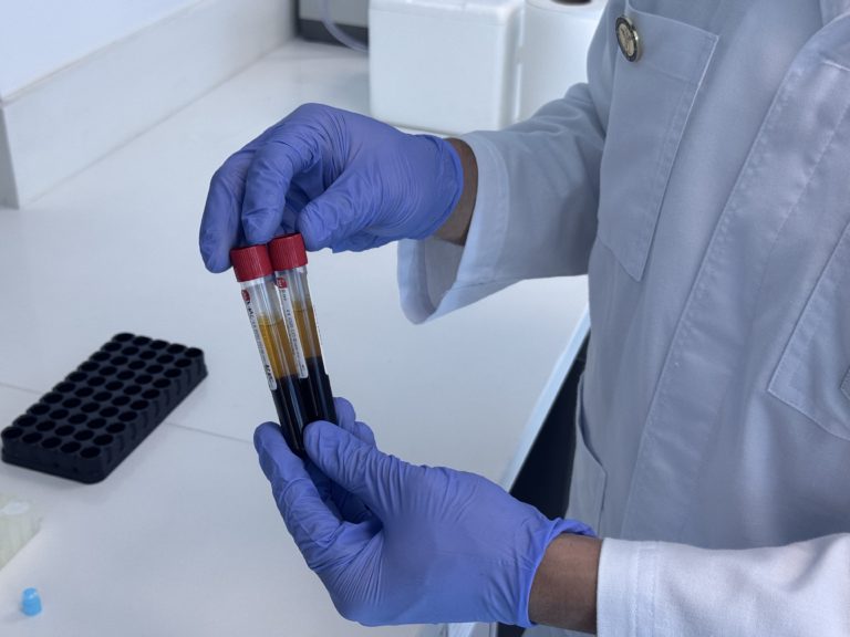 UCR: Prueba para la detección ultratemprana de nueve tipos de cáncer ya está disponible al público