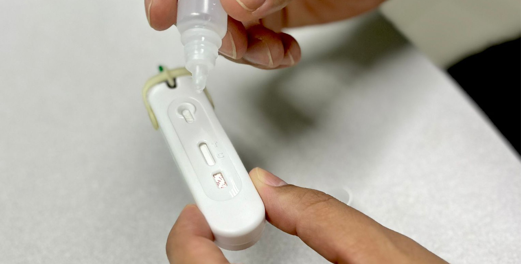 Imagen principal del artículo: Microbiólogos piden cautela en el uso de autopruebas de VIH y recomiendan confirmar resultados en laboratorio