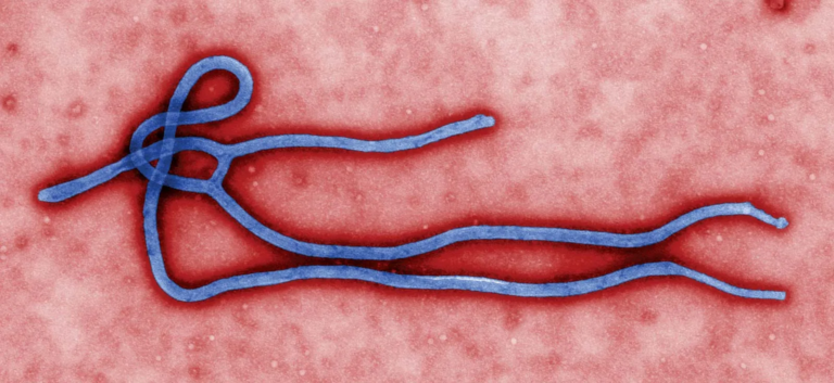 OMS declara emergencia internacional por brote de ébola en Congo y Uganda
