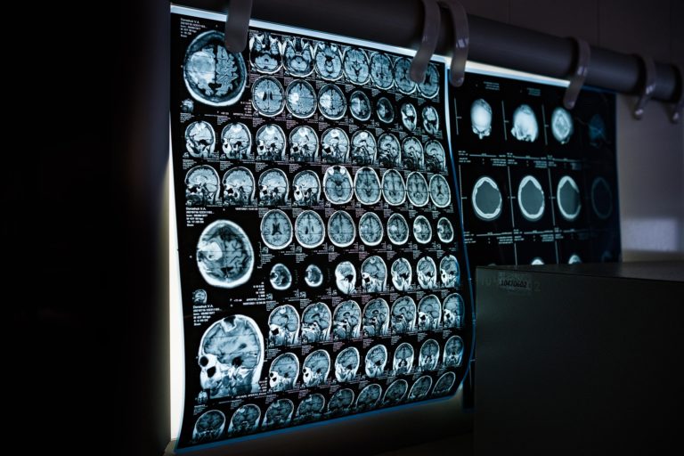 La inteligencia artificial plantea un nuevo reto para la tecnología biomédica